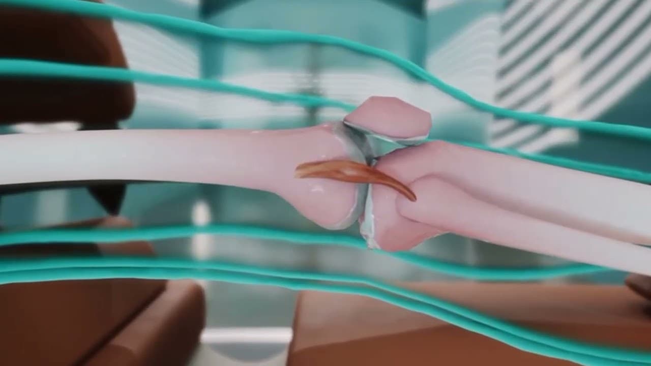 3D wellness-device animation